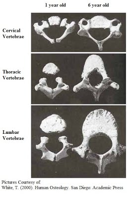 H2S Vertebrae rear facing